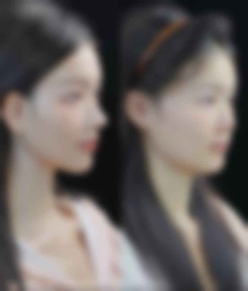 遵义泊美雅医疗美容医院求美者反馈