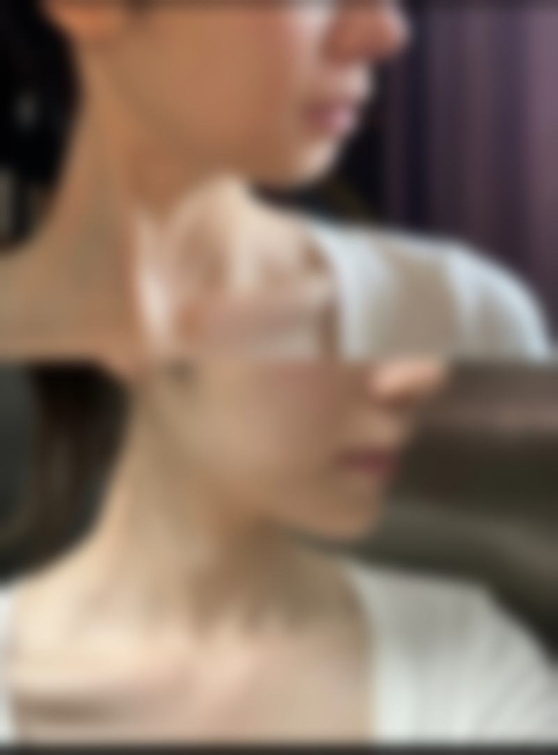 清远媄媄整形医院价格收费