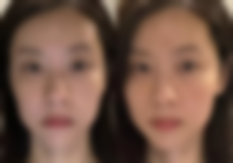 成都心悦容医疗美容医院求美者反馈
