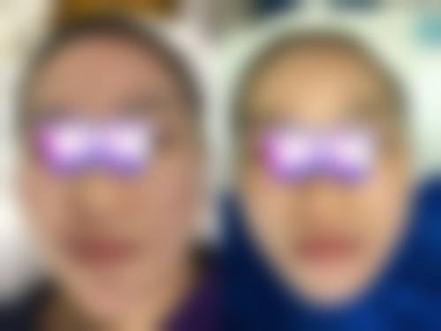 预约黄虎医生面诊,定制专属变得更美方案
