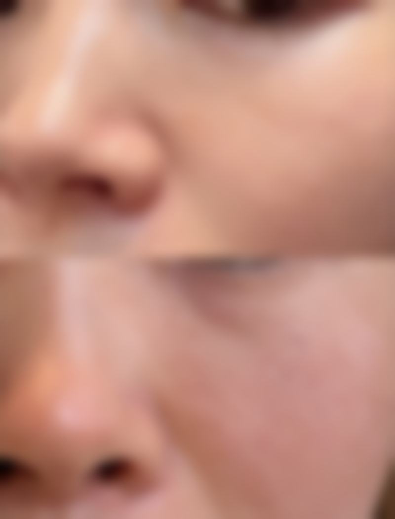 张家界华艺微整形医学美容中 心求美者反馈