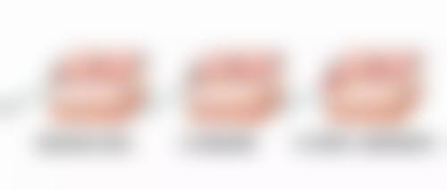李文锋医生:坚持**术前30分钟精细化沟通**