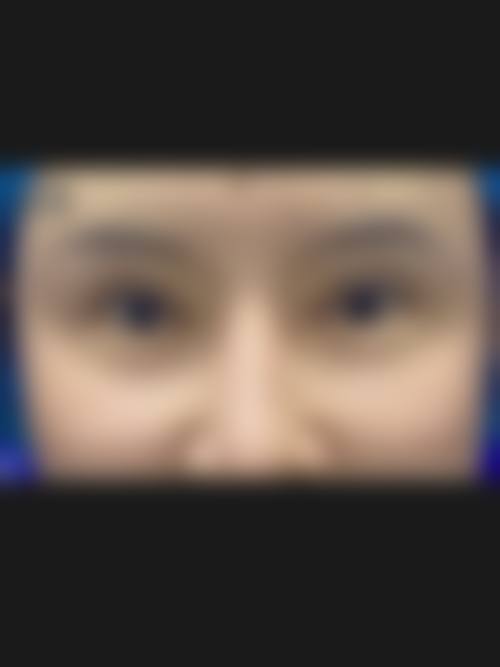 商丘市梁园区颜小柒医疗美容诊所求美者反馈