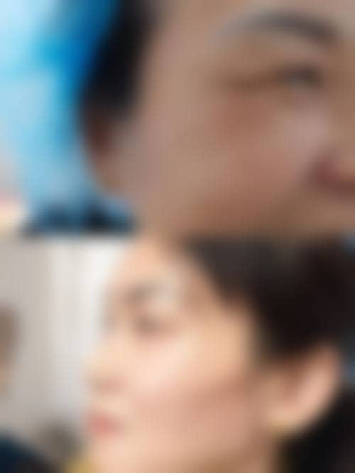 临沧悦颜整形医院求美者反馈