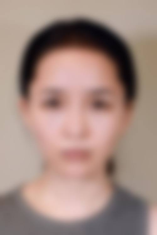 晋中蜜浠新颜整形医院求美者反馈