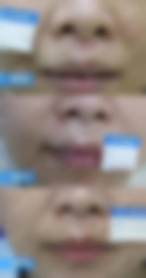连云港中医院价格收费
