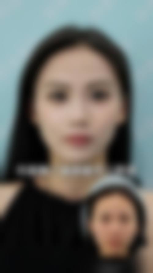 贵阳艺龄医疗美容医院求美者反馈