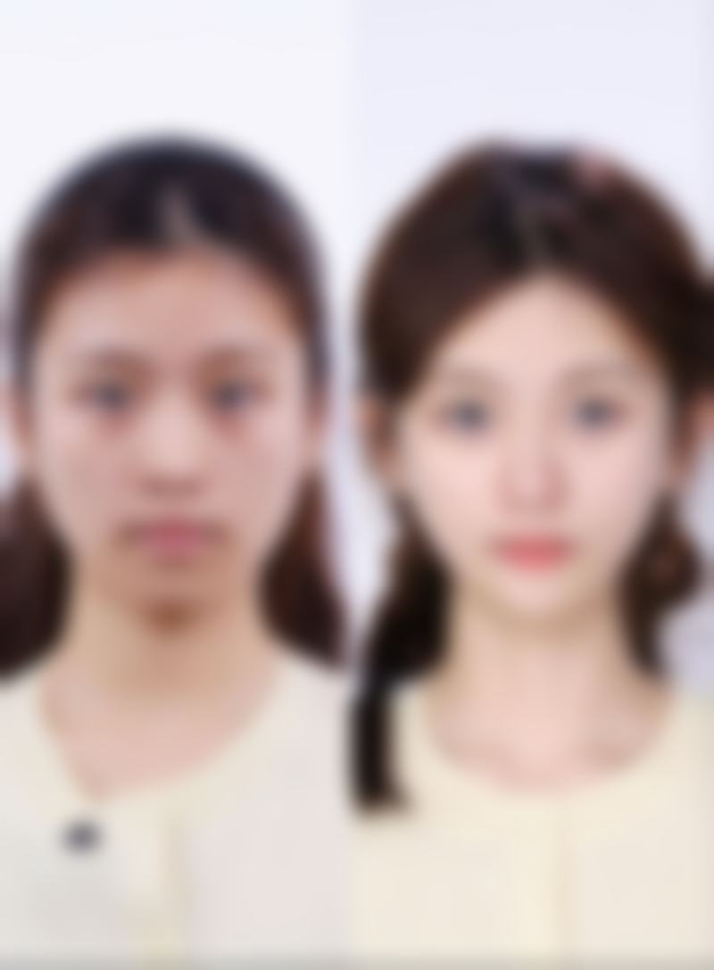 东莞壹加壹整形医院特色项目及技术优势