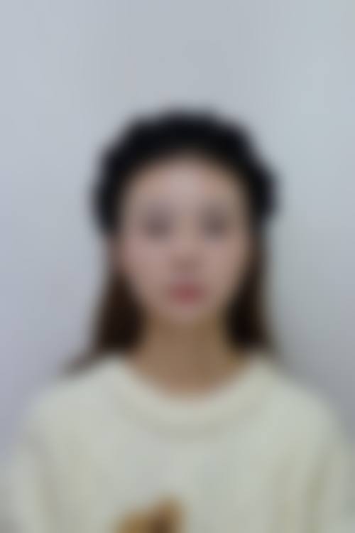 王长林医生精细化的医美操作标准