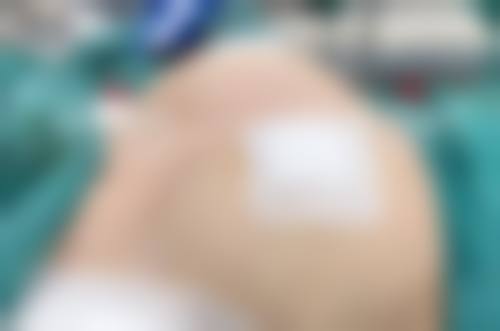 杰医德jade整形医院求美者反馈