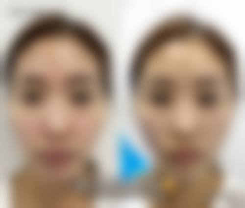 江门侨都华美整形美容医院特色项目及技术优势