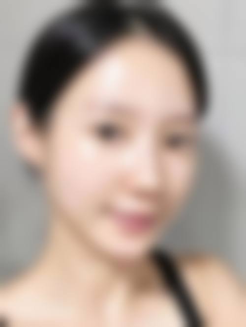 重庆玺雅医疗美容诊所求美者反馈