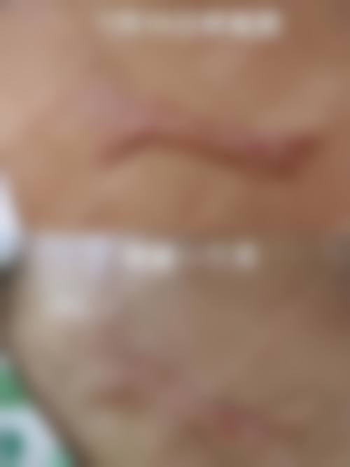 成都锦一医院求美者反馈