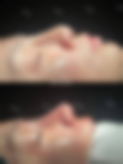 常州赵群医疗美容诊所求美者反馈