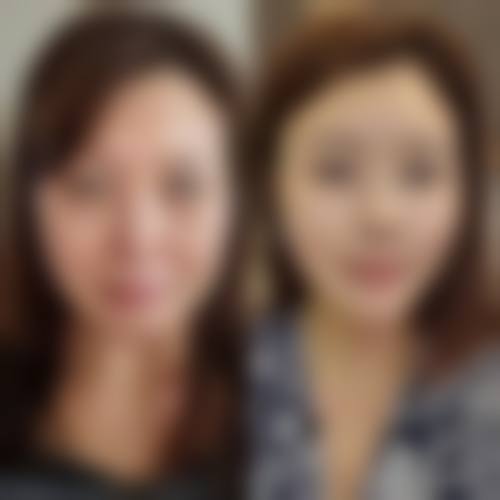 珠海郭闫伏整形医院价格收费