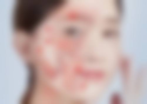 Newk医院价格收费