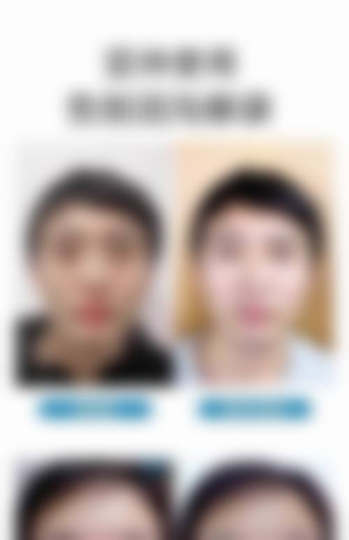 秦宏伟的临床口碑与就医指引