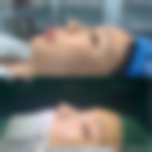 清远华美整形门诊部求美者反馈