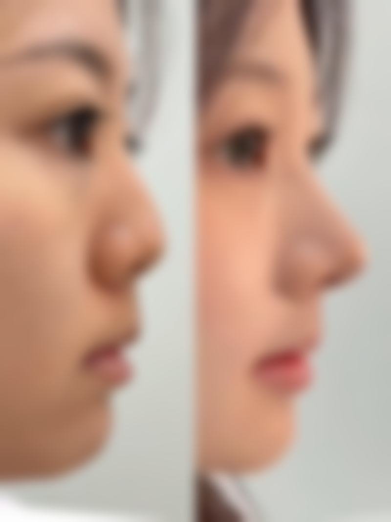 河南熙禾整形医院求美者反馈