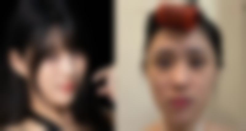 无锡玫茜医疗美容门诊部求美者反馈