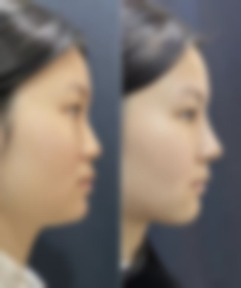 成都美悦约美医疗美容诊所求美者反馈