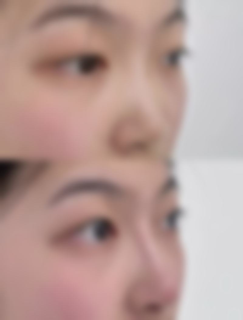 杭州美禾美医疗美容诊所价格收费