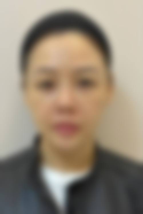 宁波颜植术医疗美容诊所价格收费