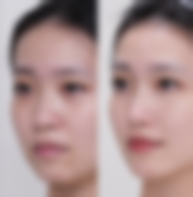 佛山洛瑾颜优嘉整形医院求美者反馈