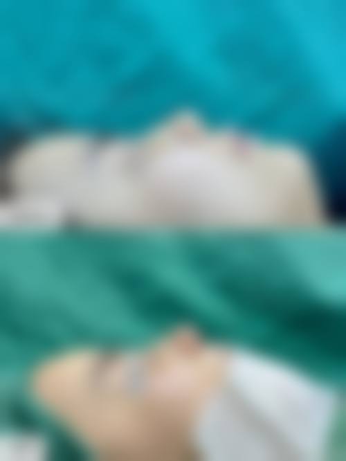 郑州懿恩医疗美容门诊部求美者反馈