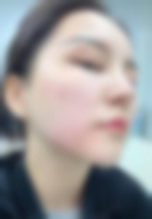 选择车旺医生的安心医美保护