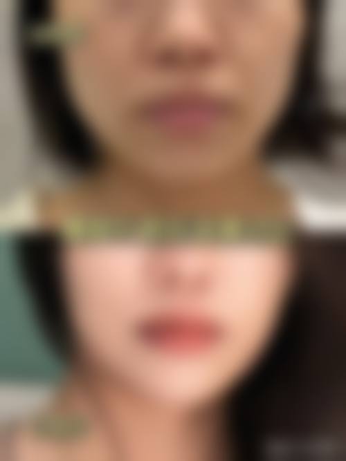 株洲雅美医疗美容门诊部：便捷贴心的预约服务