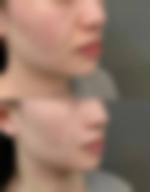 成都可巨颜医疗美容诊所价格收费
