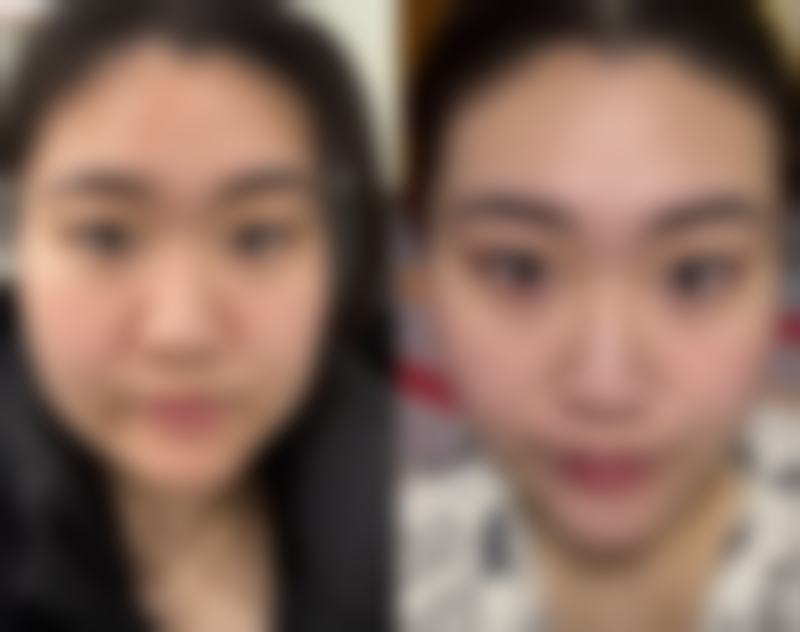 成都可巨颜医疗美容诊所求美者反馈