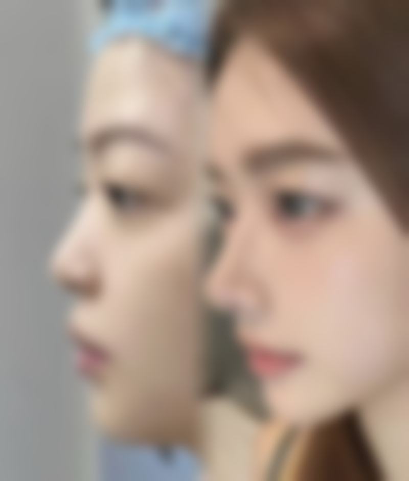 百色焱美医疗美容诊所求美者反馈