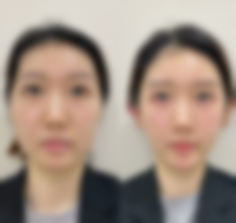 欧艾尔整形外科价格收费