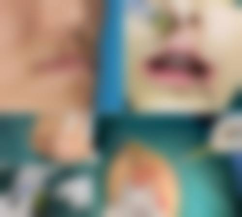 咸阳现代女子医院整形美容中 心求美者反馈