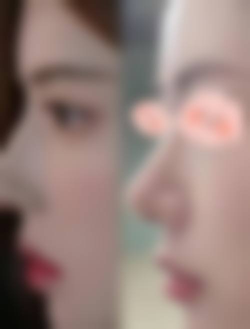 大连王艇医疗美容诊所求美者反馈