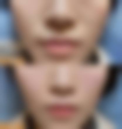 遵义医学校附属医院美容医院价格收费