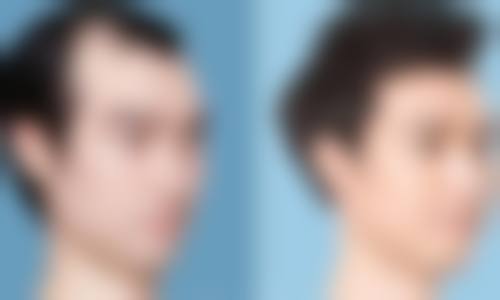 武汉新时尚医学整形美容门诊部求美者反馈