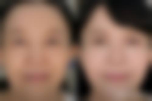 西安圣梦尚嘉整形医院求美者反馈