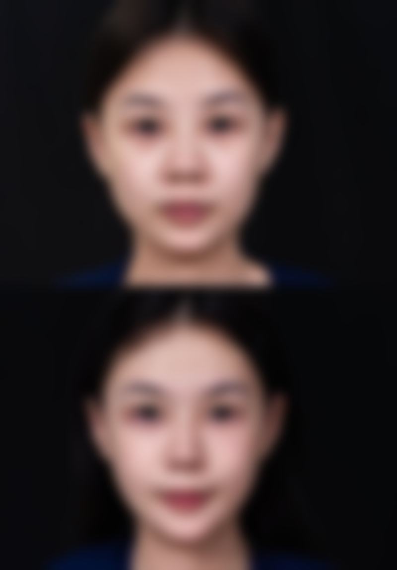 广州美恩整形美容医院求美者反馈