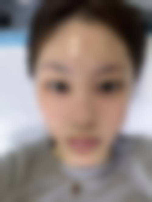 山东佰瑞德泰安医疗美容诊所求美者反馈