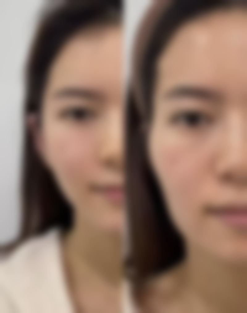 日本惠比寿美容外科医院特色项目及技术优势