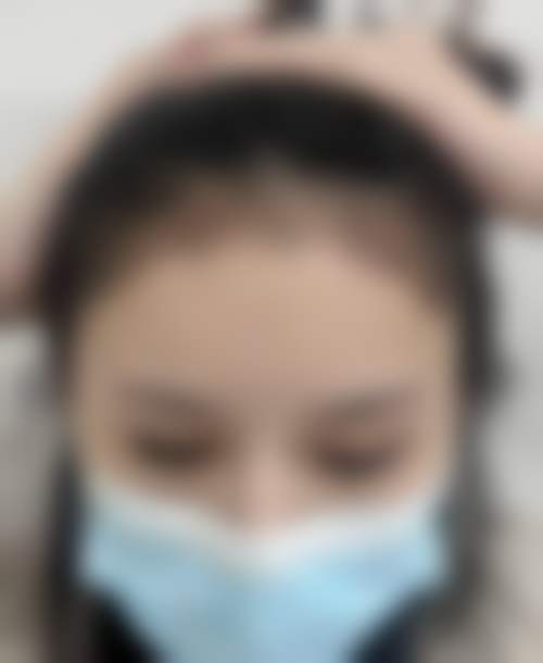 黄志春医生可开展的全品类毛发诊疗项目