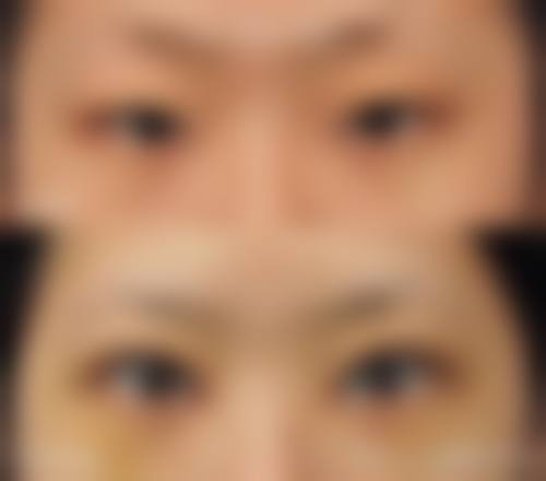 成都高新区觅桃整形医院特色项目及技术优势