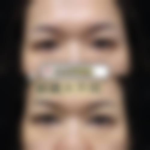 成都高新区觅桃整形医院求美者反馈