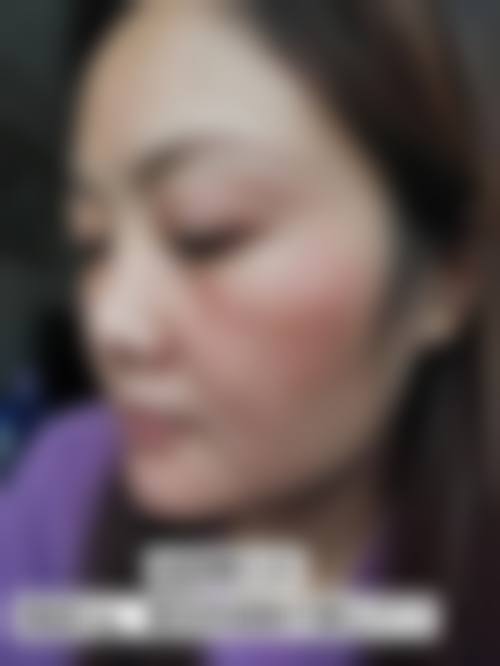 李德医生坐诊的正规医疗保护
