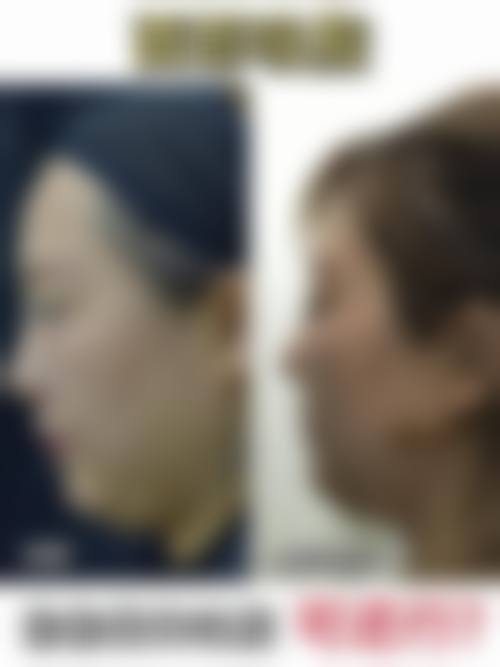枣庄星美医疗美容求美者反馈