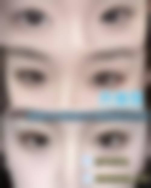 广州佰华利整形医院价格收费