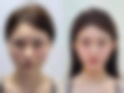 黄石素颜医疗美容门诊部价格收费